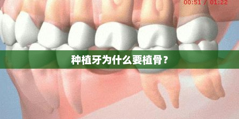种植牙为什么要植骨？